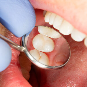 Comprehensive dental exams