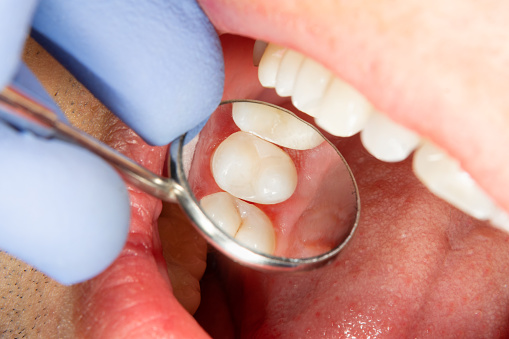 Comprehensive dental exams